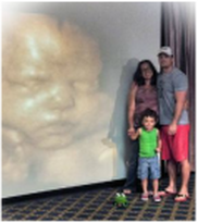 3D 4D Ultrasound family photo